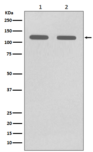 [KD]CD146 Rabbit mAb ABZ5334