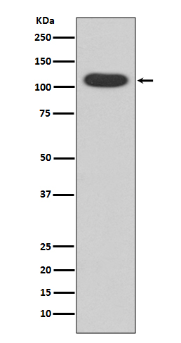 [KO]Aryl Hhydrocarbon Receptor Rabbit mAb ABZ5335