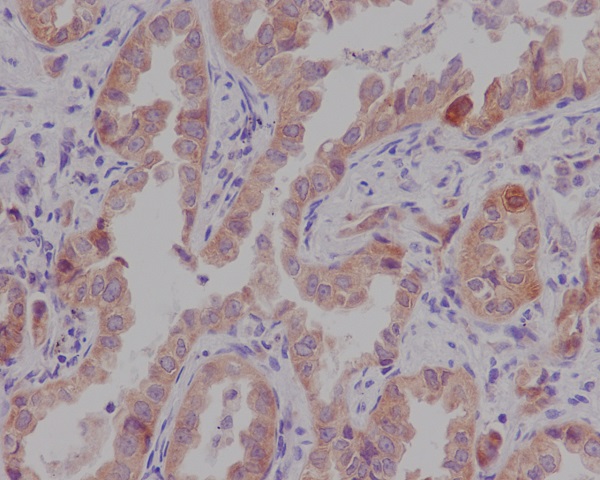 [KD]CTNNA1 Rabbit mAb ABZ5336