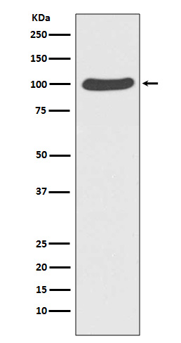 [KD]CTNNA1 Rabbit mAb ABZ5336