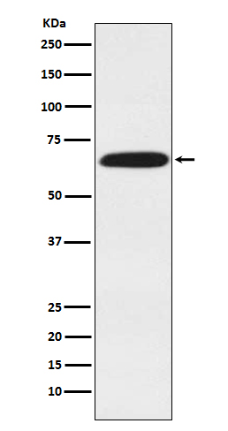 [KD]DDX5 Rabbit mAb ABZ5337