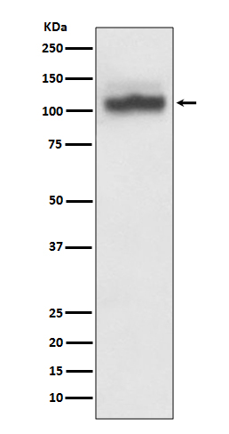 [KD]SERCA2 ATPase Rabbit mAb ABZ5338