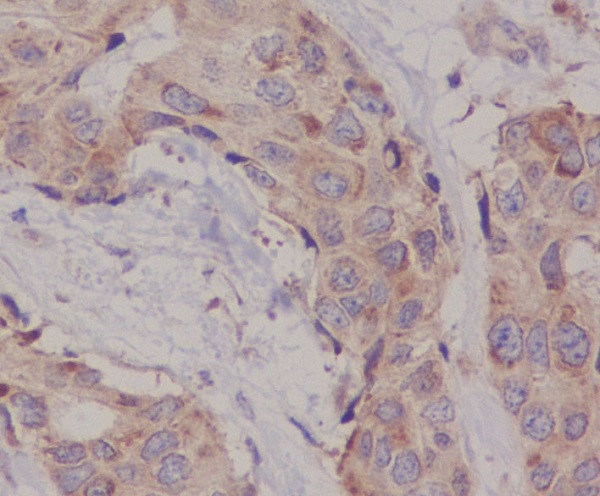[KD]Hsc70 Rabbit mAb ABZ5340