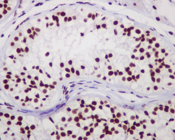 [KD]Chk2 Rabbit mAb ABZ5341