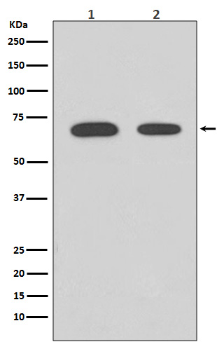 [KD]Chk2 Rabbit mAb ABZ5341