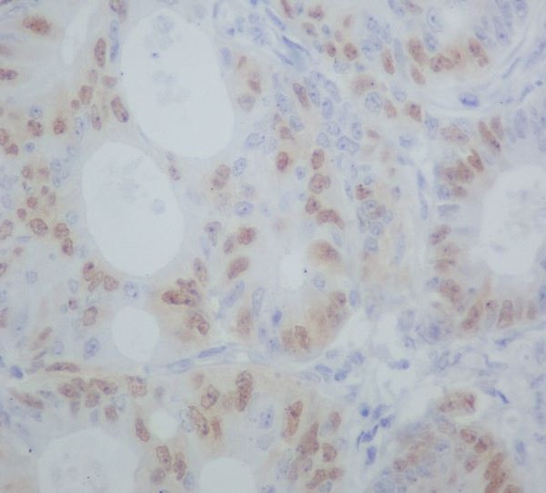 [KD]Cyclin A1/A2 Rabbit mAb ABZ5342