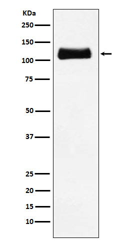 [KO]ApoER2 Rabbit mAb ABZ5344