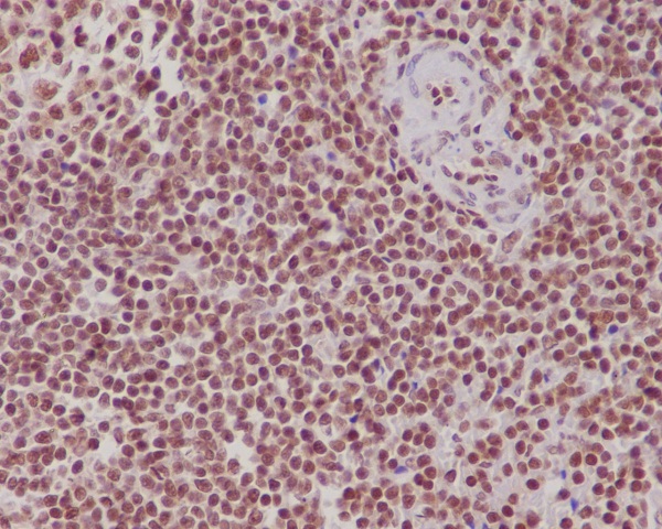 [KD]FUBP1/FBP Rabbit mAb ABZ5345