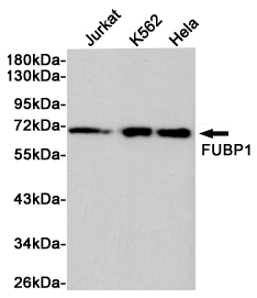 [KD]FUBP1/FBP Rabbit mAb ABZ5345