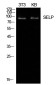 CD62P Rabbit pAb ABZ1529