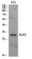 Prostate Specific Antigen Rabbit pAb ABZ1549
