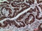 GLB1/Beta-galactosidase Rabbit pAb ABZ1551