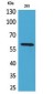 Placental Alkaline Phosphatase Rabbit pAb ABZ1569