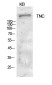 Tenascin C Rabbit pAb ABZ1573