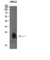 Plasminogen Receptor Rabbit pAb ABZ1637
