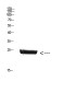 Placental Lactogen Rabbit pAb ABZ1638