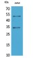 Myoblast Determination Protein 1 Rabbit pAb ABZ1669