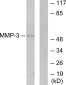 MMP3 Rabbit pAb ABZ1677