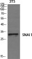 SNAIL Rabbit pAb ABZ1679