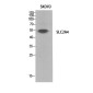 Glucose Transporter GLUT4 Rabbit pAb ABZ1683