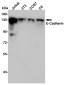 E Cadherin Rabbit pAb ABZ1688