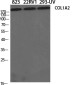COL1A2 Rabbit pAb ABZ1693