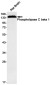 Phospholipase C beta 1/PLCB1 Rabbit mAb ABZ1707
