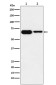 IGF2BP2 Rabbit mAb ABZ1711