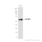 IGF2BP2 Rabbit mAb ABZ1711