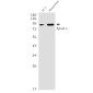 Epsin 1 Rabbit mAb ABZ1714