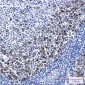 TACC3 Rabbit mAb ABZ1715