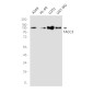 TACC3 Rabbit mAb ABZ1715