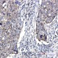 Junctional Adhesion Molecule 1/JAM-A Rabbit mAb ABZ1718