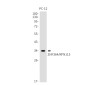 RNF115 Rabbit mAb ABZ1723