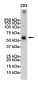 TRAF6 Rabbit mAb ABZ1727
