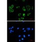 TTC11/FIS1 Protein Rabbit mAb ABZ1729