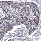 TTC11/FIS1 Protein Rabbit mAb ABZ1729