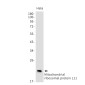 Mitochondrial Ribosomal Protein L11 Rabbit mAb ABZ1731