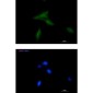 NDUFAF1 Rabbit mAb ABZ1735