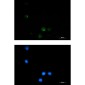 SSX2IP Rabbit mAb ABZ1740