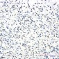 SSX2IP Rabbit mAb ABZ1740