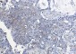 ATF5 Rabbit mAb ABZ1741