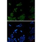 Phospholipase A2 Activator Protein Rabbit mAb ABZ1742