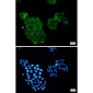 AKT Rabbit mAb ABZ1743