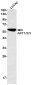 AKT Rabbit mAb ABZ1743