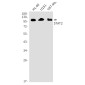 STAT2 Rabbit mAb ABZ1745
