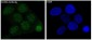 SATB2 Rabbit mAb ABZ1748