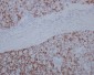 SATB2 Rabbit mAb ABZ1748