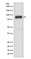SATB2 Rabbit mAb ABZ1748