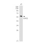USP22 Rabbit mAb ABZ1749